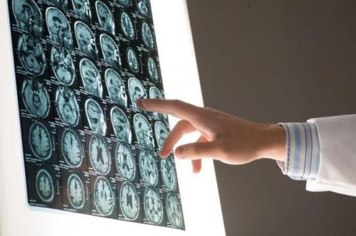 Долю обрабатываемых нейросетями медицинских изображений в Москве довели до 40%